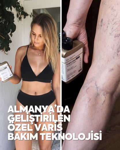 Varicose 100 - Almanya'dan İthal